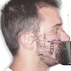 Simulación de Tratamiento Dental y Facial